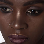 Buttercup Foundation