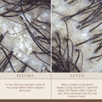 Good Biome Seborrheic Scalp Solution (DUO): Herbal Prebiotic Leave-in